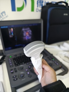Échographe vétérinaire Doppler couleur entièrement numérique Sonoscape X3V, offre directe usine, pour la conservation de la faune. - Product Image 2
