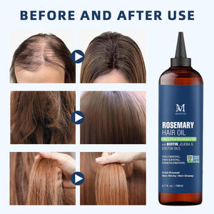 Private Label 200ml Rosmarin Haarwuchsöl Haarstärkung Kopfhautpflege Haarwuchsöl zur Täglichen Anwendung Kräuter-Haarwuchsöl - Product Image 1