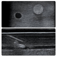Modelo de Práctica de Biopsia Multiaobjetivo 3 en 1 IG007-S1 para Lesiones de Vasos y Nervios, con Guía de Ultrasonido para Entrenamiento Integral de Punción