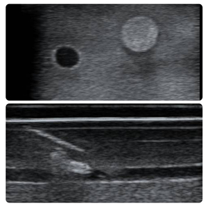 Modelo de Práctica de Biopsia Multiaobjetivo 3 en 1 IG007-S1 para Lesiones de Vasos y Nervios, con Guía de Ultrasonido para Entrenamiento Integral de Punción - Product Image 3