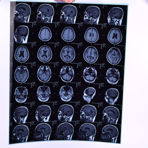 Film laser médical sec 11x14 pouces à base bleue pour imagerie CT, IRM, DR, compatible avec les imageries <span class=keywords><strong>Agfa</strong></span>, Fuji, Carestream - Product Image 2
