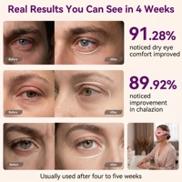 Appareil facial EMS chinois pour éliminer les poches sous les yeux, lunettes de massage à lumière rouge pour les cernes, les gonflements et le soulagement de la fatigue oculaire