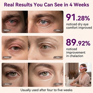 Portable 3d Acupoint Relax Eye Massager Electric Eye Relaxation Machine Eye-<b>Red</b>-<b>Light</b>-<b>Therapy</b> for Dark Circle, Eye-Strain-Relief - Product Image 4