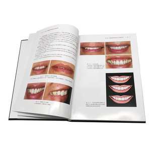 Materiales Dentales: Blanqueamiento Dental, Carillas de Porcelana, Catálogo de Carillas de Porcelana Total, Álbum de Fotos de Cristal, Exhibidor - Product Image 3