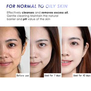 Desmaquillador de limpieza profunda de aminoácidos suaves de pH bajo, limpiador Facial de ácido débil para el cuidado diario de la piel o desmaquillador - Product Image 5