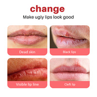 Hot Sale Vrouwen Dagelijkse Hydraterende Lipverzorging Private Label Lichtmakende Bleekcrème Balsem 5g Fruit Verwijdert Lippenbeschadigingen