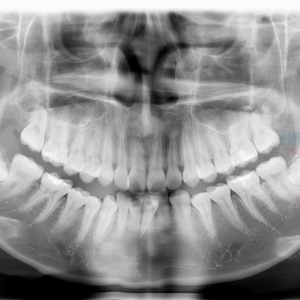 Máy chụp <span class=keywords><strong>X</strong></span>-quang nha khoa kỹ thuật số Planmeca Promax 3D <span class=keywords><strong>Panoramic</strong></span> Pano+ceph+CBCT đã qua sử dụng - Product Image 6