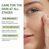 Sérum à 10 % d'acide azélaïque avec Centella Asiatica et Niacinamide pour contrôler le sébum, apaiser les rougeurs et estomper les marques d'imperfections du visage