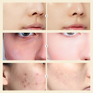 AuQuest crème d'escargot Marque privée Bio Hydratant longue durée Réparateur Anti-âge Crème blanchissante pour le visage d'escargot - Product Image 6