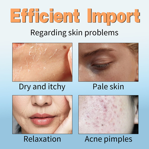 Nouveau pistolet de mésothérapie sous vide, injecteur facial sans aiguille, hydratant, anti-rides, portable, ABS, pour le corps entier, beauté américaine - Product Image 3