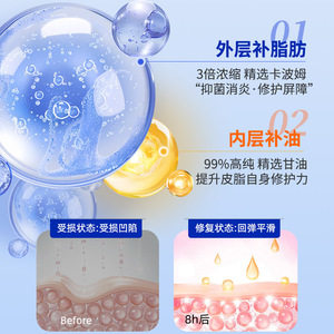 Crema para las Quemaduras de Frío Zhuochen, Crema Anti-Picazón y para Piel Seca y Agrietada, Producto Original, Previene las Quemaduras de Frío en Niños, Manos y - Product Image 1