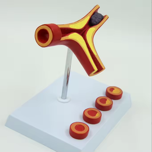 Model Pembelajaran arteri SCIEDU Model pengajaran sumber daya gray Anatomy manusia Model penyakit arteri koroner - Product Image 5