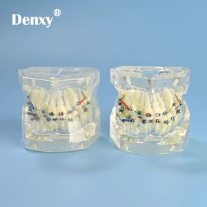 Denxy-modelo de ortodoncia para ortodoncia Dental, modelo principal transparente extraíble, soporte de Metal transparente, ligadura, atado de dientes - Product Image 1