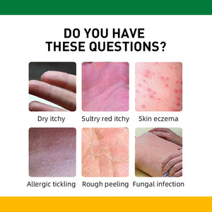 Meilleures ventes de <span class=keywords><strong>crème</strong></span> de soin à base de plantes pour réparer les ampoules anti-démangeaisons des mains et des pieds - Product Image 6