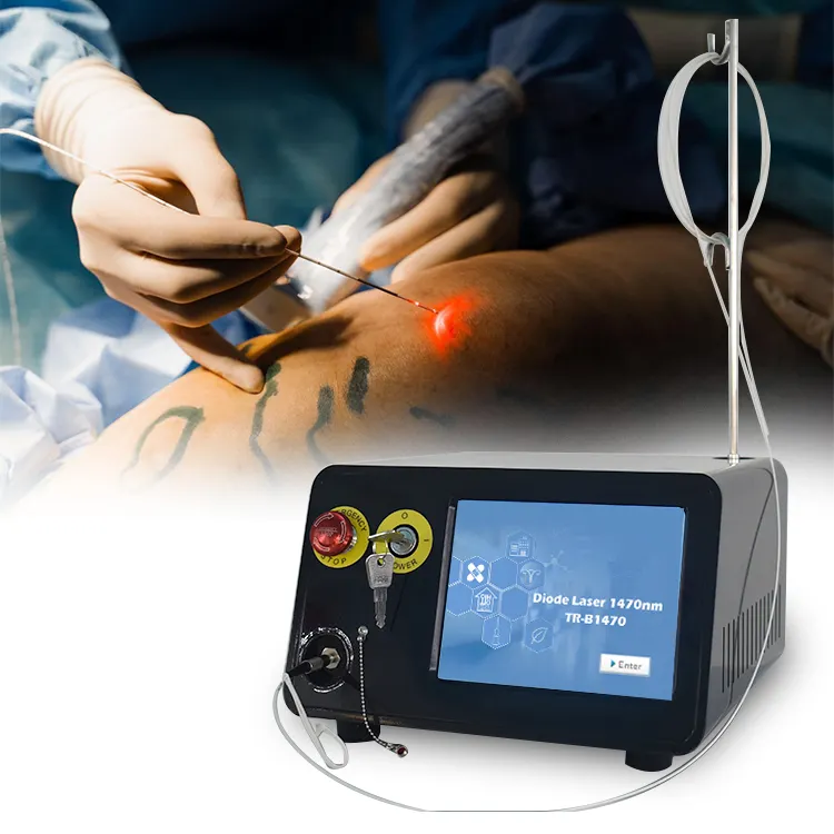 静脈瘤デバイス用の血管内ダイオードレーザー切除evlt1470静脈内レーザー
