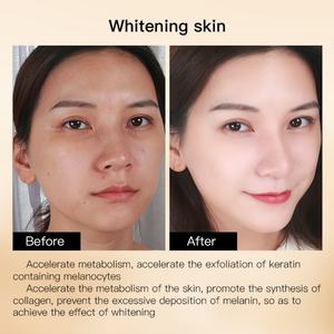 Tratamiento para el Acné Facial, Reduce las Líneas Finas, Arrugas y Manchas Oscuras, Suero con Niacinamida - Product Image 4