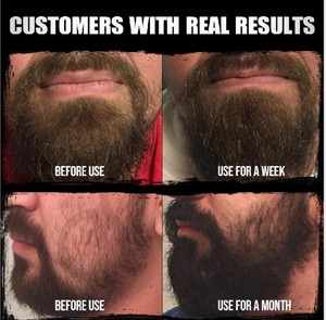 Venta al por mayor creciendo la <span class=keywords><strong>barba</strong></span> tratamiento etiqueta privada para hombre Regalos de crecer la <span class=keywords><strong>barba</strong></span> aceite kit de 4pcs - Product Image 5