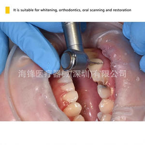 ที่เปิดปากไฮเฟิง 3 มิติ สำหรับงานทันตกรรม ใช้สำหรับจัดฟันและฟอกสีฟัน สำหรับผู้ใหญ่ ขนาดมาตรฐาน - Product Image 3