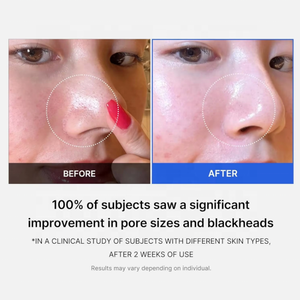 แผ่นเช็ดทำความสะอาดรูขุมขน Zero Pore Pad ของเกาหลี Medicube ผลิตภัณฑ์ดูแลผิวหน้า ด้วยกรดซาลิไซลิก ช่วยผลัดเซลล์ผิว ลดรูขุมขน ด้วย <span class=keywords><strong>AHA</strong></span> <span class=keywords><strong>และ</strong></span> <span class=keywords><strong>BHA</strong></span> - Product Image 4