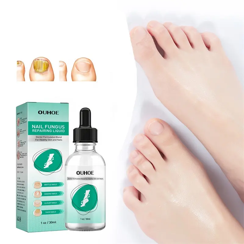 OUHOE 30ml unha fungo reparar infecções fúngicas líquidas unha descoloração unhas rachado unhas reparar solução brilho