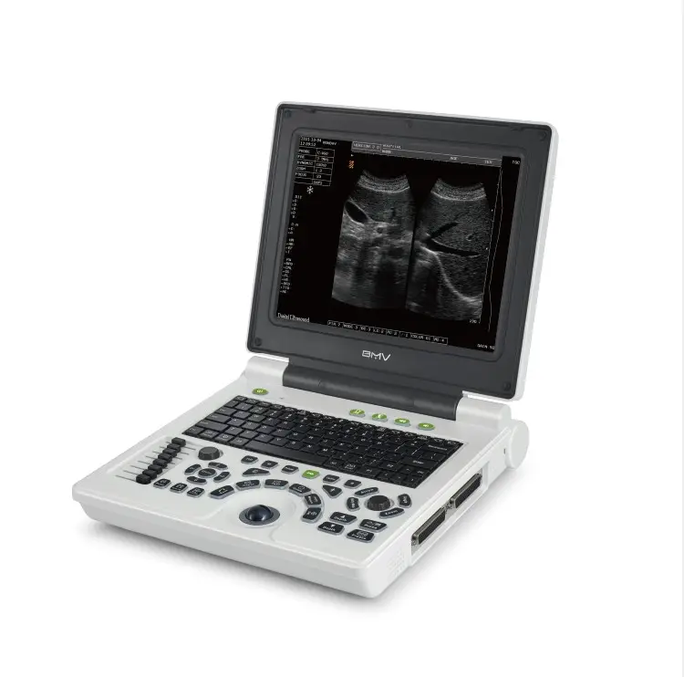 Ucuz dizüstü bilgisayar siyah ve beyaz ultrason tarayıcı makinesi sistemi