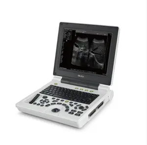 Günstiges Laptop Schwarz-Weiß-Ultraschallscanner-Maschinen system
