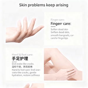 Ungüento para Grietas en los <span class=keywords><strong>Pies</strong></span>, Reparación Profunda para Talones Secos y Agrietados, Piel Dura, Hidratante, Alivio para Trabajadores que Están de Pie, Cuidado Diario - Product Image 6