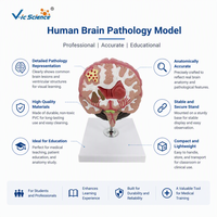 Modèle médical de pathologies cérébrales, modèle anatomique de maladies du cerveau pour l'enseignement médical, affichage des structures pathologiques, CE ROHS ISO