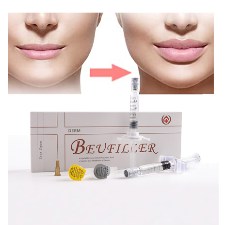 Коллагеновый наполнитель ha, корея, корейский сертификат ce, объем губ для лица, под глазами, voluma derm deep voluma derma, 1 мл, 2 мл, дермальный наполнитель