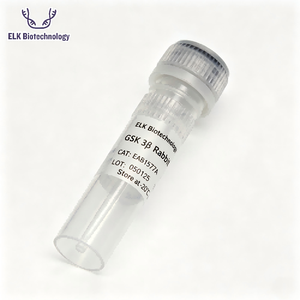 Anticorps polyclonaux de lapin <span class=keywords><strong>TIGAR</strong></span>, pour la recherche scientifique - Product Image 6