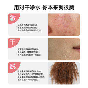 Filtro de cabezal de ducha de 4 etapas con vitamina C e iones de plata para el cuidado de la piel y descloración - Product Image 4