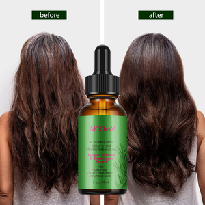 Aceite Esencial para el Cuidado del Cabello con Biotina y Romero de Marca Privada OEM, para Calmar el Cuero Cabelludo, Aliviar la Picazón y la Caspa, Equilibrar la Humedad del Cuero Cabelludo - Product Image 1