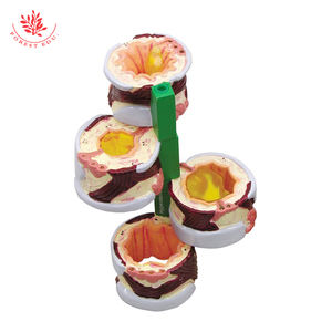 4-delige Brounchus Model Normale Zwelling Hypersecretie Spierspasmen Anatomisch Model - Product Image 3