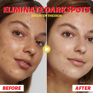 Suero Iluminador y Blanqueador con Vitaminas 30ml, Reduce <span class=keywords><strong>Manchas</strong></span> Oscuras, Aclara el Tono de Piel, Humectante No Irritante - Product Image 5