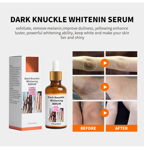 Suero Aclarante Rápido para Manos, Codos y Rodillas, Corrector de Pigmentación para Piel Oscura, Eliminador de Manchas Intensas - Product Image 5