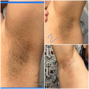 Крем для осветления кожи для темных подмышек, колен, локтей, внутренней части бедра, линии бикини, отбеливающий крем для области подмышек - Product Image 5