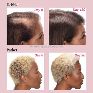 OEM ODM özel etiket saç büyüme tabletler takviyeleri biyotin ve çinko pürüzsüz saç büyüme vitamini hapları - Product Image 5