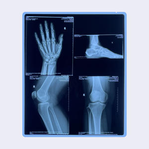 Синяя Тепловая рентгеновская пленка диагностическая медицинская сухая пленка для CT <span class=keywords><strong>DR</strong></span> MRI 8 "X10" 14 "X17" для Fuji AGFA HQ LUCKY Printers - Product Image 6