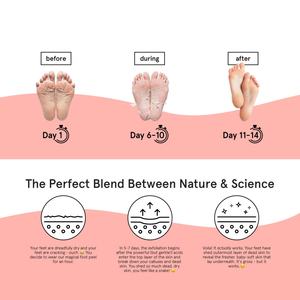 Masque exfoliant et hydratant pour les pieds, soin personnalisé de la peau des pieds, pour des pieds doux comme ceux d'un bébé - Product Image 6
