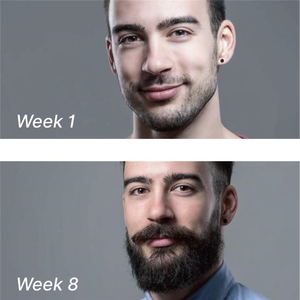 Productos para el cuidado de la barba para hombre, suero de rebrote orgánico con rodillo <span class=keywords><strong>Derma</strong></span>, Kit de crecimiento de la barba, aceite de barba, Etiqueta Privada - Product Image 3