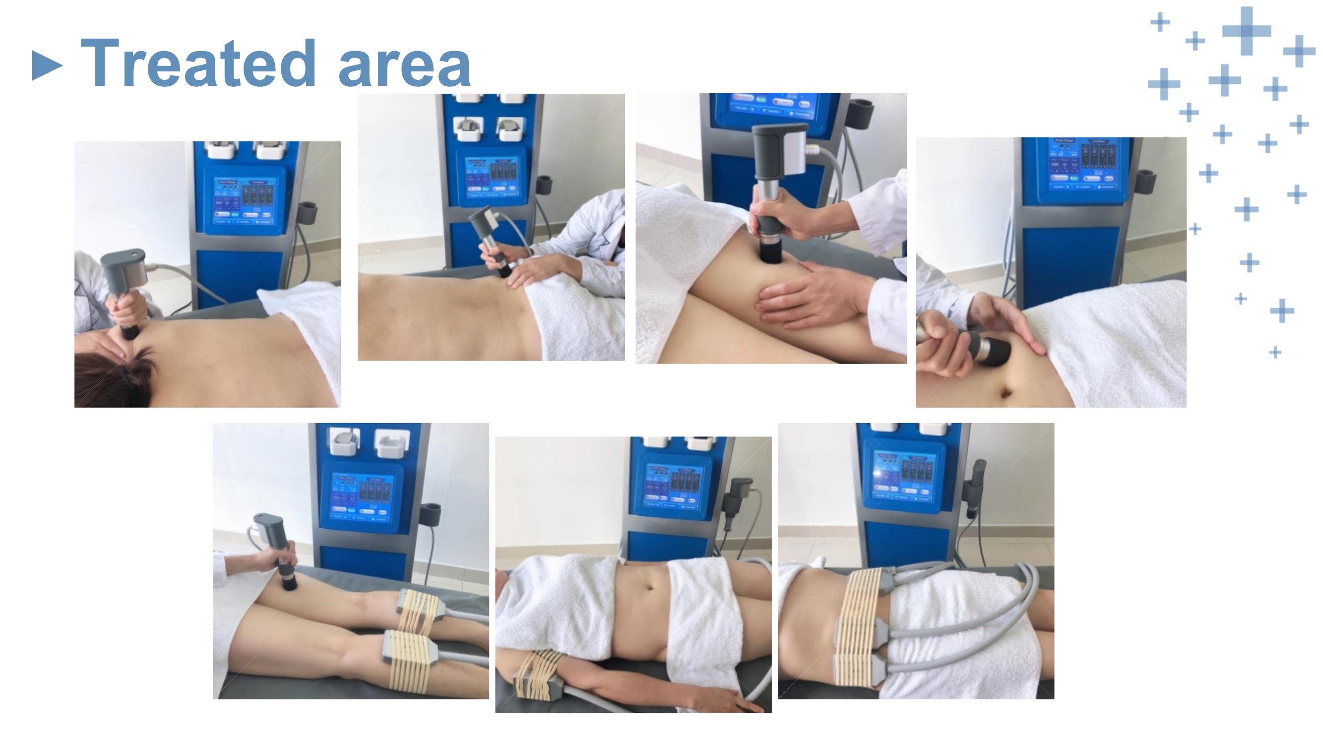 Pneumatic Shockwave Physiotherapy Criolipolysis Slimming Machine 2 in 1 Cool Pads Fat Freezing Extracorporeal Shock Wave Therapy Equipment For Pain Relief Pneumatic shock wave machine physiotherapy pain relief - Honkay shockwave therapy machine,shockwave therapy,shock wave therapy device,shock wave,shockwave therapy machine
