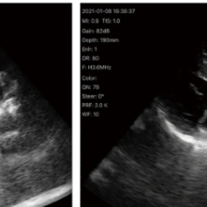 Échographe vétérinaire Doppler couleur à sonde USB et sans fil à matrice de phase, sonde cardiaque à matrice de phase CU18 - Product Image 6