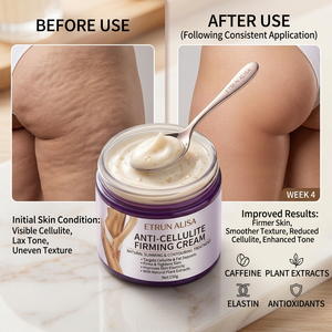 ETRUN ALISA OEM Crema Organica Rassodante e Snellente per il Corpo, Trattamento Anticellulite per Cosce, Addome, Braccia e Glutei - Product Image 4
