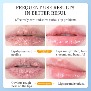 Bálsamo Labial IMAGES Korea para el Cuidado de los <span class=keywords><strong>Labios</strong></span>, Hidratación Nocturna, <span class=keywords><strong>Mascarilla</strong></span> Labial Rosa para Dormir - Product Image 5