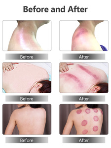 Health Slimming Machine Whole Body Sonic Resonance Sonic <b>Electric</b> <b>Massager</b> Double <b>Head</b> Body Shaping Body Care Instrument - Product Image 6