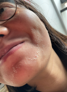 วัสดุเครื่องสําอาง Gae Peeling Powder เพื่อความงามความงามคลินิกผิว - Product Image 5