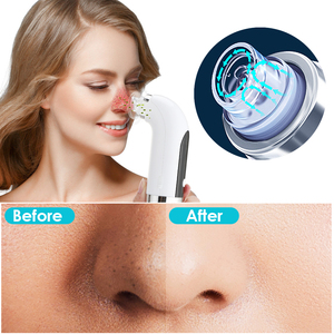 Éliminateur de points noirs du visage, électrique, nettoyeur d'acné, outil de nettoyage des pores, 1 pièce - Product Image 6