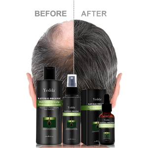 Champú para el Crecimiento del Cabello de Marca Privada Personalizado para la Pérdida de Cabello <span class=keywords><strong>y</strong></span> el Recrecimiento del Cabello, Control de Grasa e Hidratación - Product Image 5