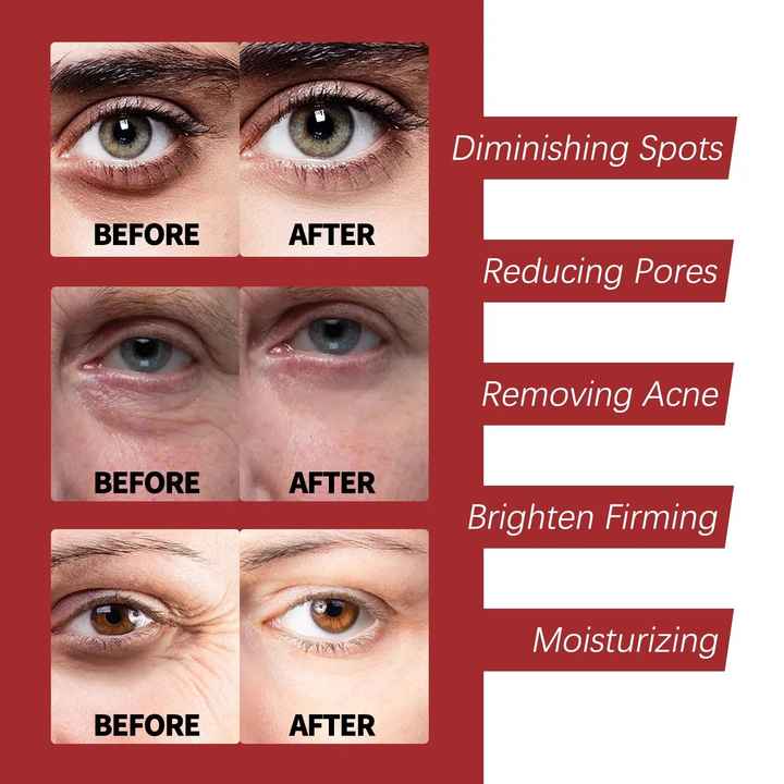 OUHOE  Fade Dark Eye Circles Hydrating Moisturizing 7 Days Fast Whitening Cream With Factory Wholesale Retinol Whitening Cream