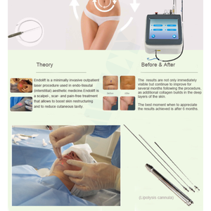 <span class=keywords><strong>Plataforma</strong></span> Láser Multifuncional de 1470nm y 980nm para Clínicas Dermatológicas, Tratamiento Vascular, Hongos en las Uñas y Lipólisis - Product Image 5